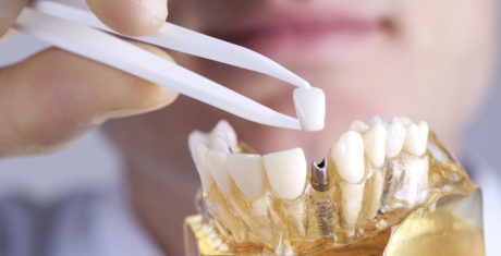specialist dentistry - teeth